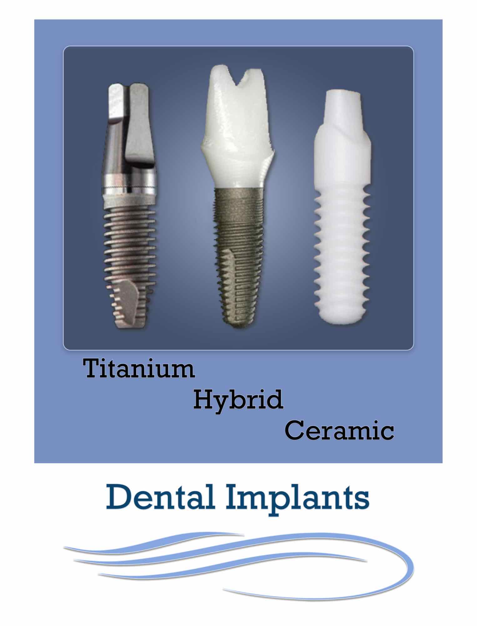 Dental Implants