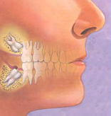 Wisdom Teeth
